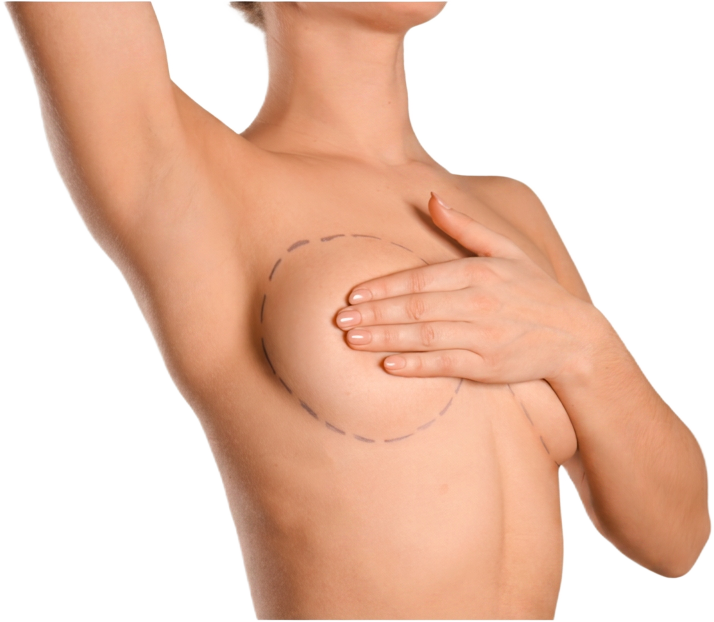 Cirurgia de Mama — Dr. Bruno Coral